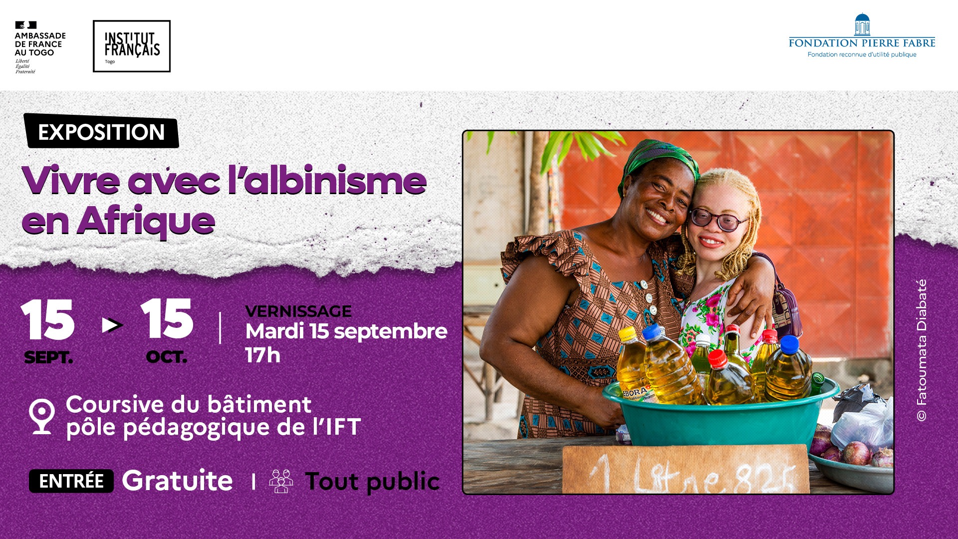 Slider_Expo_Vivre avec l’albinisme en Afrique